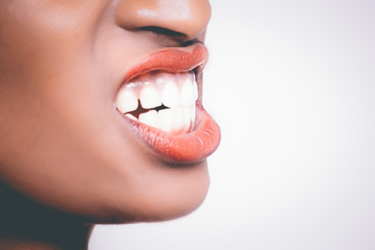 Close-up of a female mouth. Their teeth are joined. Her lips are stretched open and her gums are visible. She had a previous gingival graft operation. She's healthy now.
