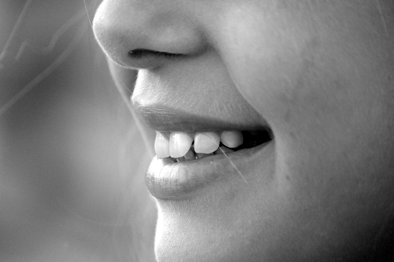 Close-up of a female mouth. Photo taken from the left side. She smiles slightly. Some of her teeth are straightened. Someone who has been treated after a broken tooth-clenching tooth.