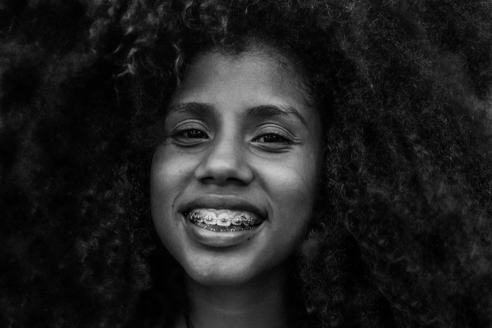 A woman undergoing orthodontic treatment. Smiling. The braces are easily visible.