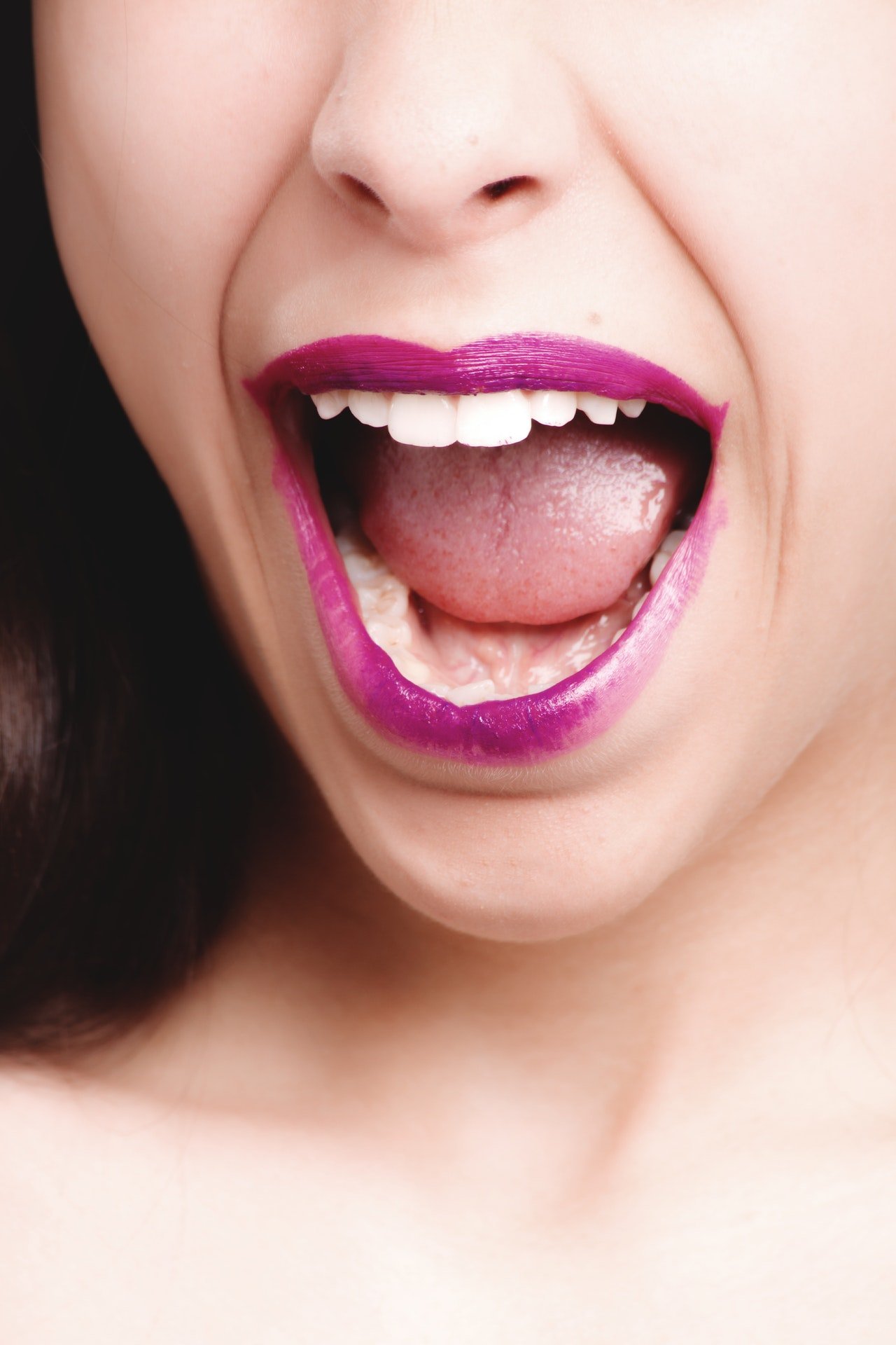 Close-up beautiful female mouth. She has had periodontal surgery before. She's healed now. Smiling.