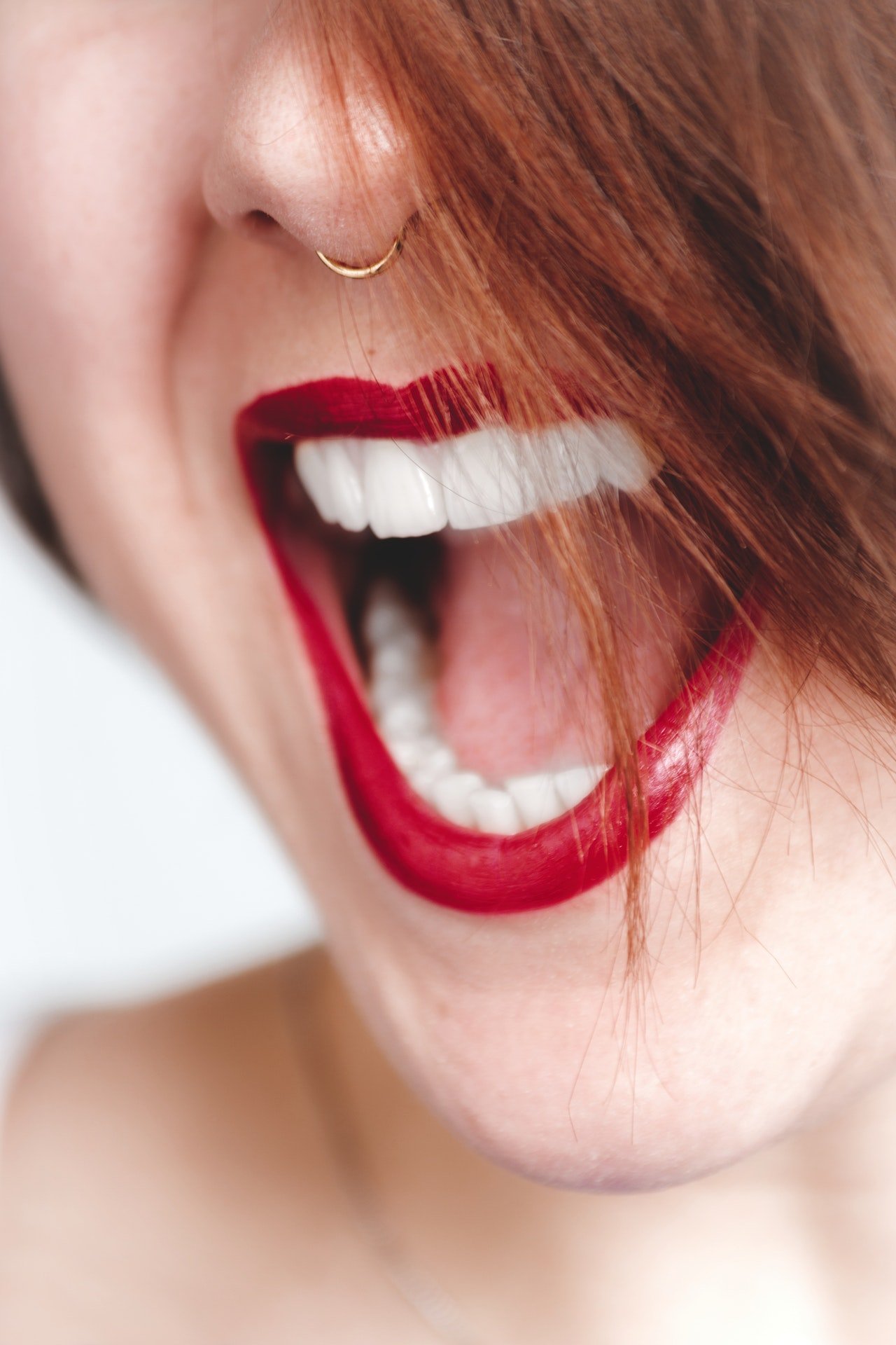 Close-up of a mouth. She opened her mouth wide as if surprised. She smiles. Her upper and lower teeth are fully visible. A woman who has had root canal treatment before.
